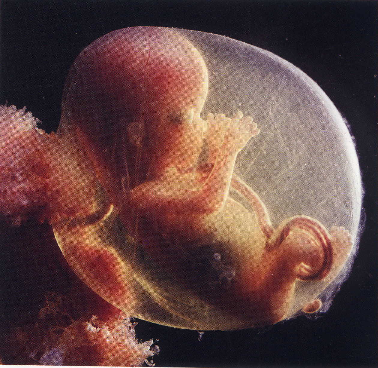 foetus 15semaines.JPG (226627 octets)