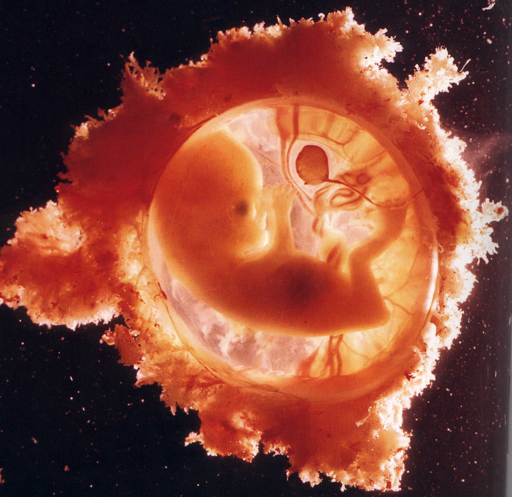 foetus 2.JPG (420468 octets)